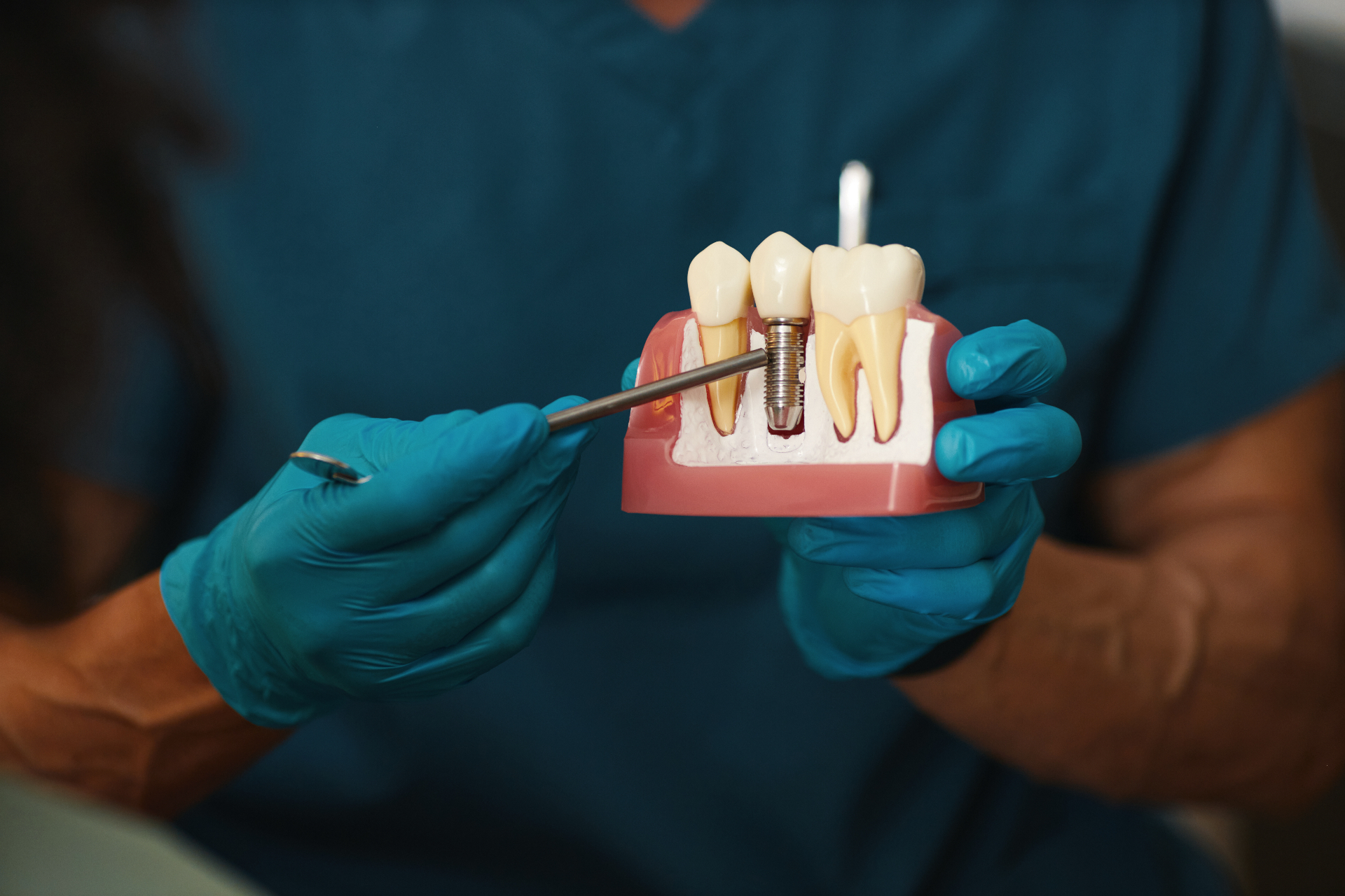 Dentist holding a dental implant model